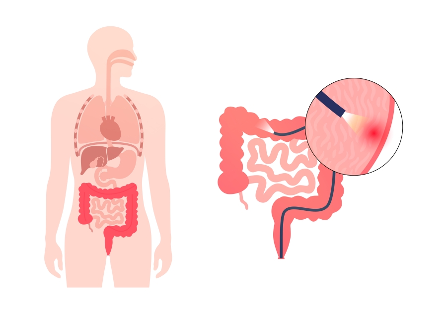 a7d435bff7eb10c6bc355bfa0bbf9d3a_1772180893_6734.jpg a7d435bff7eb10c6bc355bfa0bbf9d3a_1772180893_6734.jpg