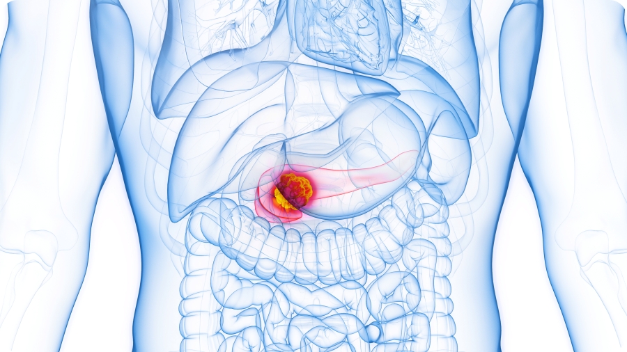 1159222e9e84d9d1bc328a6e17f7ee63_1772590194_5166.jpg 1159222e9e84d9d1bc328a6e17f7ee63_1772590194_5166.jpg