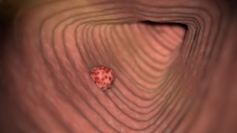 b78f6de3414be644e89157f8b1b5cd91_1775444163_731.jpg b78f6de3414be644e89157f8b1b5cd91_1775444163_731.jpg